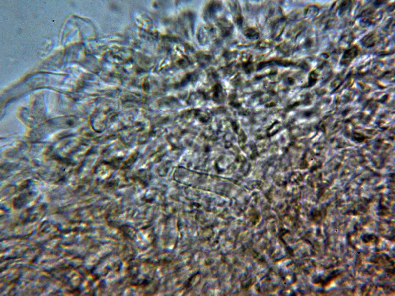 Microscopía de Spodocybe collina - 10 - Suprapellis agua 1